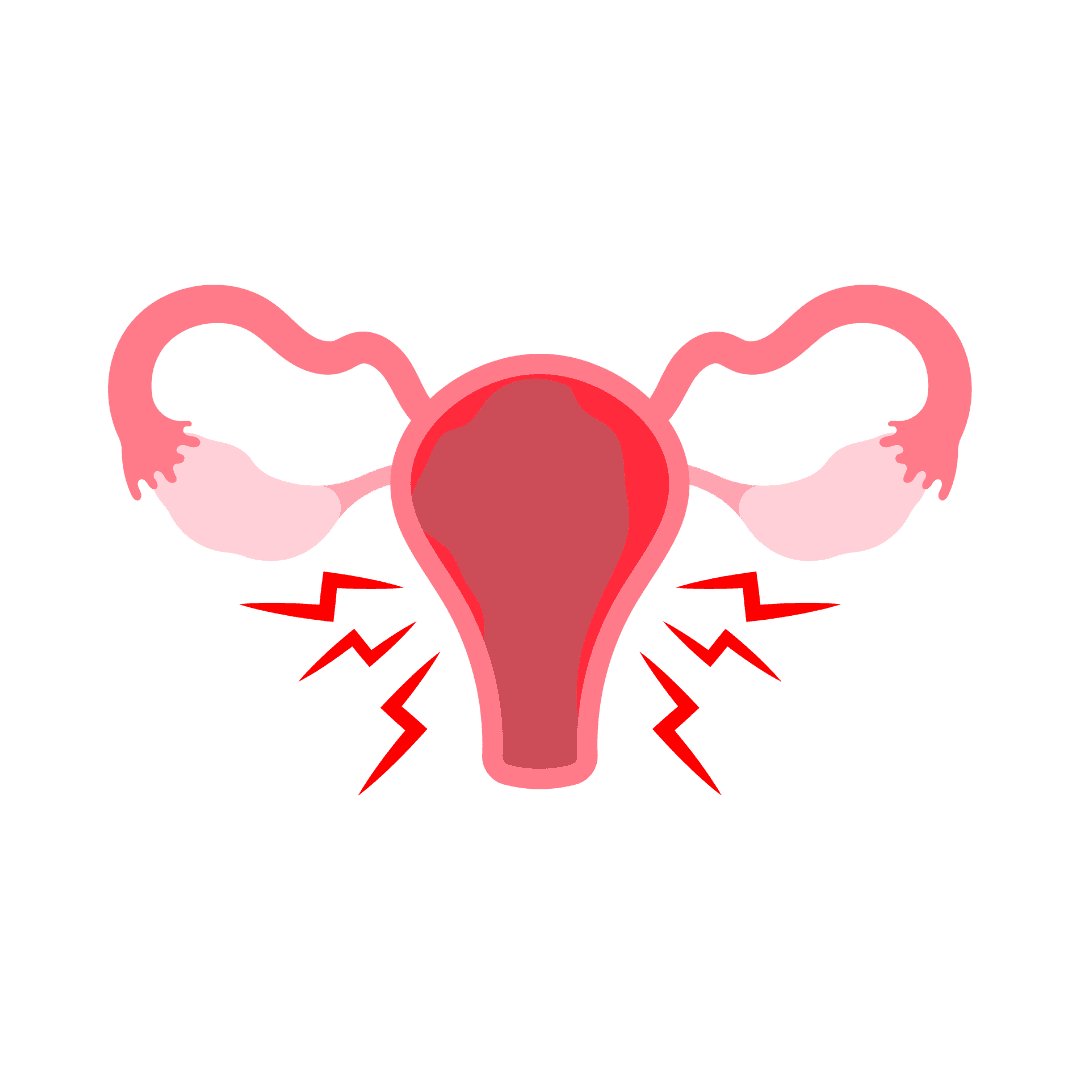Endométriose