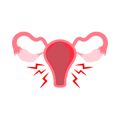 Endométriose