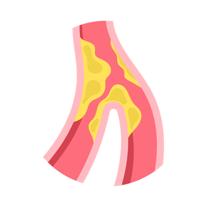 L'athérosclérose