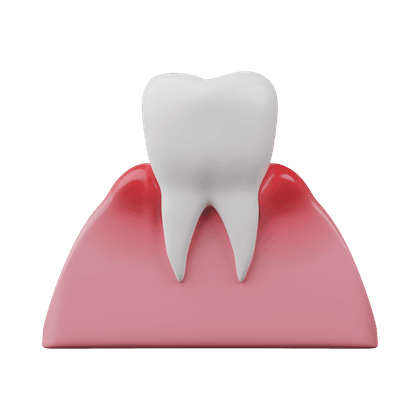 Inflammation des gencives, gingivite, parodontite